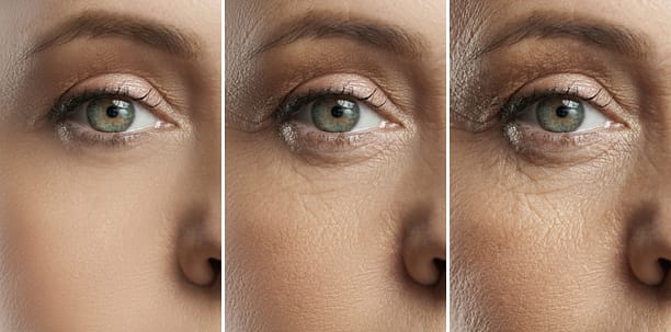 Three close-up images of the same person's aging eye, showing the progression of fine lines and wrinkles over time. The left image shows smooth skin, the middle shows some wrinkles, and the right shows more pronounced wrinkles